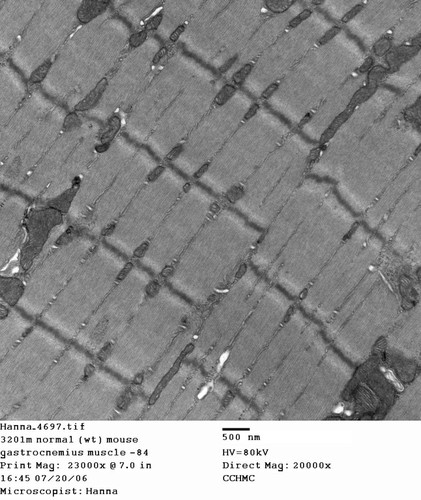 CIL:346, Mus musculus, skeletal muscle cell