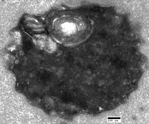 CIL:40445, Saccharomyces cerevisiae, sac1∆ mutant