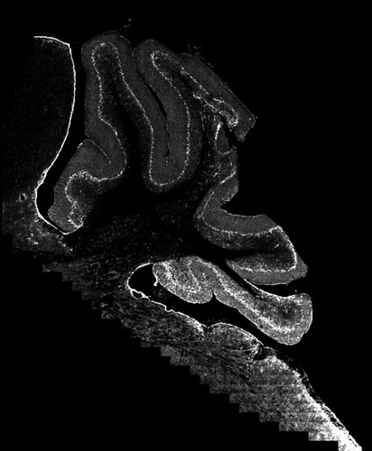 CIL:40197, Mus musculus, CNS neuron (sensu Vertebrata), astrocyte of the cerebellum