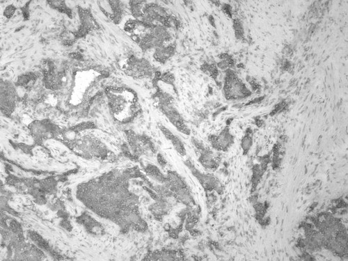 CIL:33564, Homo sapiens, endocrine-paracrine cell of prostate gland, basal cell of prostate epithelium, luminal cell of prostate epithelium, blood vessel endothelial cell, perineural cell, sheath cell, leukocyte, prostate stromal cell, smooth muscle cell of prostate