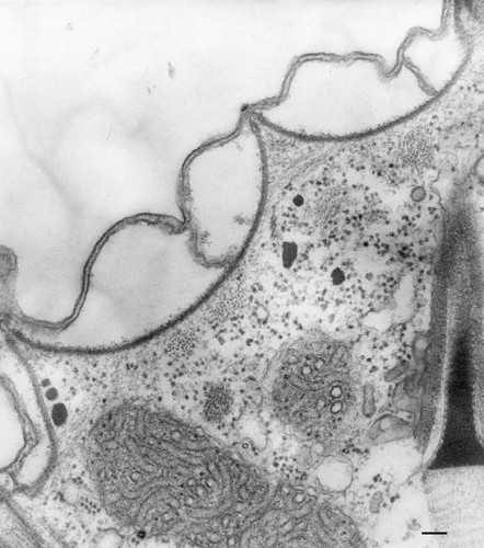 CIL:36599, Paramecium multimicronucleatum, cell by organism, eukaryotic cell, Eukaryotic Protist, Ciliated Protist