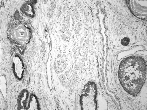 CIL:32369, Homo sapiens, endocrine-paracrine cell of prostate gland, basal cell of prostate epithelium, luminal cell of prostate epithelium, blood vessel endothelial cell, perineural cell, sheath cell, leukocyte, prostate stromal cell, smooth muscle cell of prostate