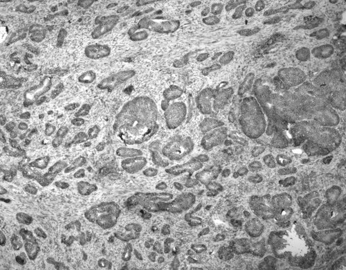 CIL:33663, Homo sapiens, endocrine-paracrine cell of prostate gland, basal cell of prostate epithelium, luminal cell of prostate epithelium, blood vessel endothelial cell, perineural cell, sheath cell, leukocyte, prostate stromal cell, smooth muscle cell of prostate