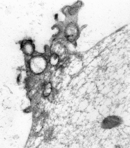 CIL:40557, Paramecium multimicronucleatum, cell by organism, eukaryotic cell, Eukaryotic Protist, Ciliated Protist