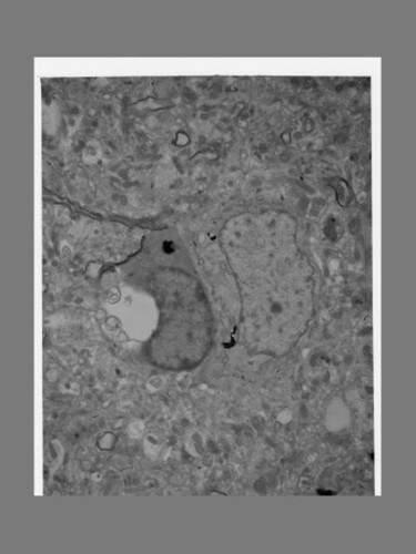 CIL:40189, Homo sapiens, pyramidal cell, neuron of cerebral cortex