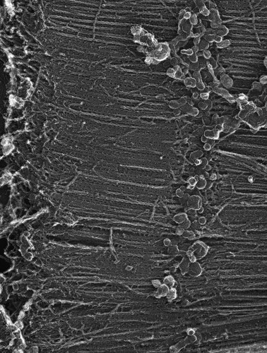 CIL:36021, damselfly, flight muscle cell