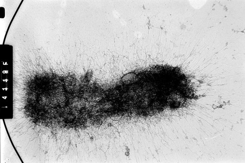 CIL:35385, Homo sapiens, cevical carcinoma