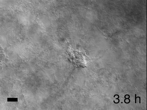 CIL:42165, Homo sapiens, epithelial cell