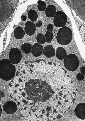 CIL:35995, Rhipicephalus appendiculatus, glandular epithelial cell