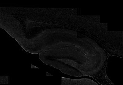 CIL:40199, Mus musculus, CNS neuron (sensu Vertebrata), astrocyte of the hippocampus