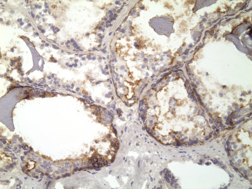 CIL:32203, Homo sapiens, endocrine-paracrine cell of prostate gland, basal cell of prostate epithelium, luminal cell of prostate epithelium, blood vessel endothelial cell, perineural cell, sheath cell, leukocyte, prostate stromal cell, smooth muscle cell of prostate