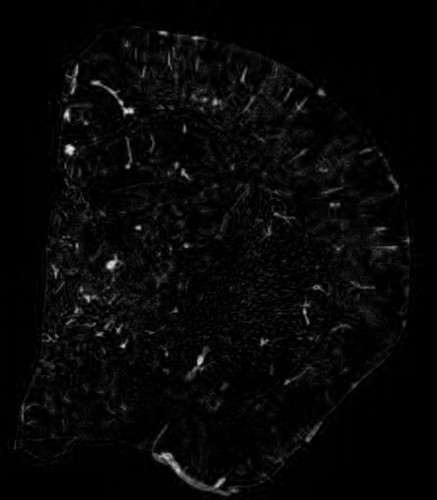 CIL:40239, Mus musculus, CNS neuron (sensu Vertebrata), glial cell, blood vessel endothelial cell