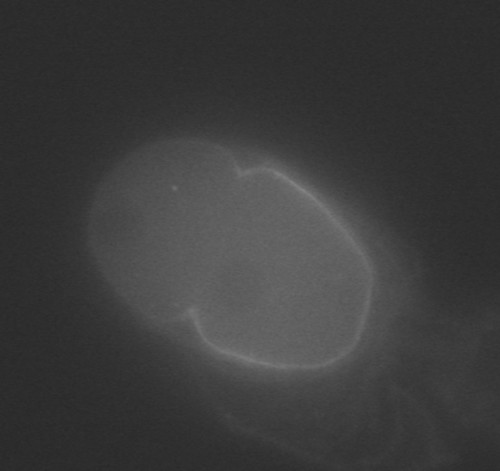 CIL:37933, Caenorhabditis elegans, early embryonic cell