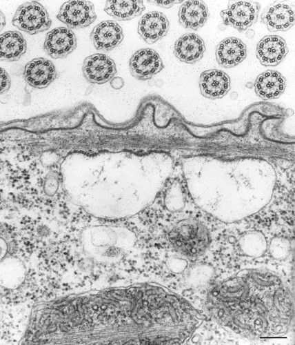 CIL:36274, Vorticella convallaria, cell by organism, eukaryotic cell, Eukaryotic Protist, Ciliated Protist