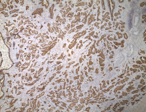 CIL:34256, Homo sapiens, endocrine-paracrine cell of prostate gland, basal cell of prostate epithelium, luminal cell of prostate epithelium, blood vessel endothelial cell, perineural cell, sheath cell, leukocyte, prostate stromal cell, smooth muscle cell of prostate