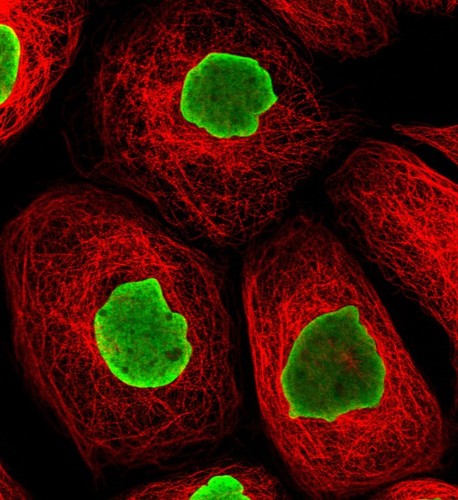 CIL:41693, Homo sapiens, epidermoid carcinoma