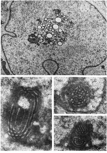 CIL:11041, Barbus tauricus, Homo sapiens, Sertoli cell, glandular cell of endometrium