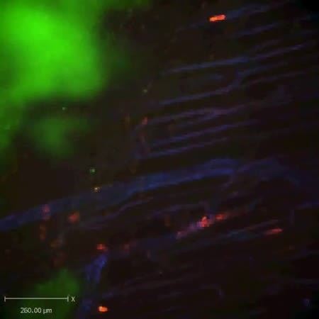 CIL:47546, Staphylococcus aureus, neutrophil, endothelial cell