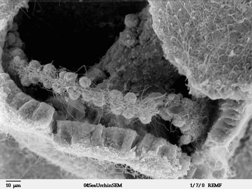 CIL:39785, Lytechinus pictus, mesenchymal cell
