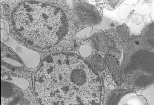 CIL:558, Acetabularia mediterranea, gamete