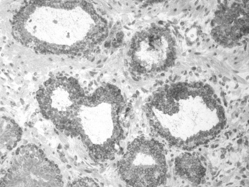 CIL:33684, Homo sapiens, endocrine-paracrine cell of prostate gland, basal cell of prostate epithelium, luminal cell of prostate epithelium, blood vessel endothelial cell, perineural cell, sheath cell, leukocyte, prostate stromal cell, smooth muscle cell of prostate