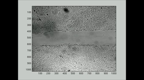 CIL:43419, Mus musculus, mammary adenocarcinoma