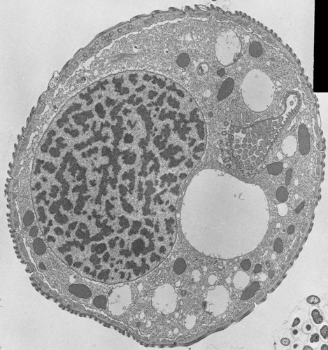 CIL:39193, Opercularia [NCBITaxon:168247], Opercularia coarctata, cell by organism, eukaryotic cell, Eukaryotic Protist, Ciliated Protist