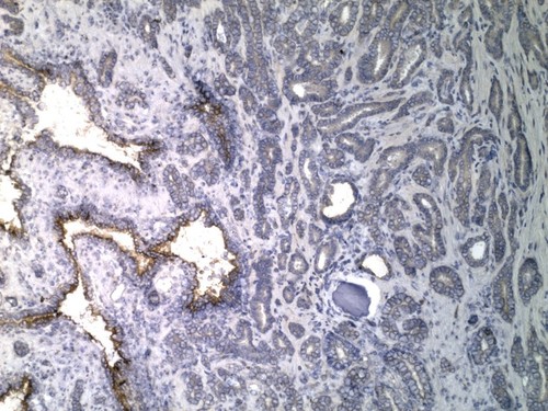 CIL:32626, Homo sapiens, endocrine-paracrine cell of prostate gland, basal cell of prostate epithelium, luminal cell of prostate epithelium, blood vessel endothelial cell, perineural cell, sheath cell, leukocyte, prostate stromal cell, smooth muscle cell of prostate