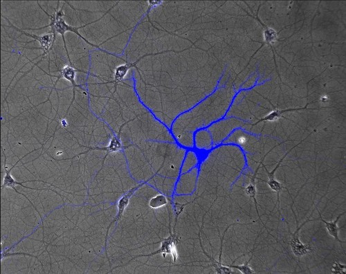 CIL:847, Rattus, multipolar neuron, hippocampal neuron in vitro