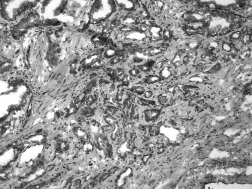 CIL:34056, Homo sapiens, endocrine-paracrine cell of prostate gland, basal cell of prostate epithelium, luminal cell of prostate epithelium, blood vessel endothelial cell, perineural cell, sheath cell, leukocyte, prostate stromal cell, smooth muscle cell of prostate