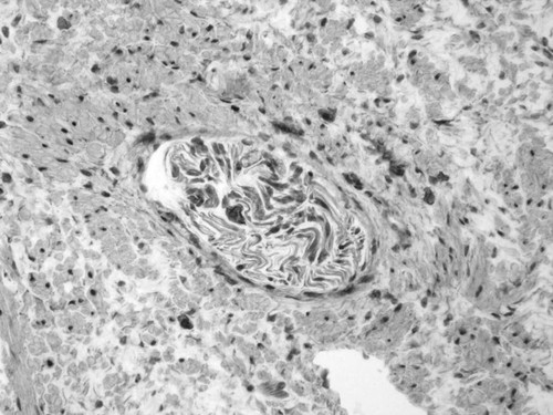 CIL:33678, Homo sapiens, endocrine-paracrine cell of prostate gland, basal cell of prostate epithelium, luminal cell of prostate epithelium, blood vessel endothelial cell, perineural cell, sheath cell, leukocyte, prostate stromal cell, smooth muscle cell of prostate