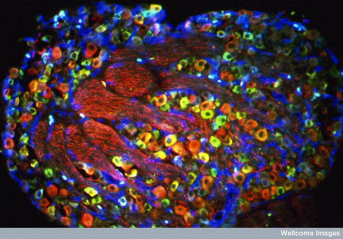 CIL:38965, sensory neuron, peptidergic neuron, myelinated A fibers, non-peptidergic pain neurons