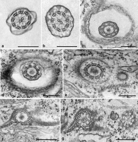 CIL:36229, Tetrahymena pyriformis, cell by organism, eukaryotic cell, Eukaryotic Protist, Ciliated Protist