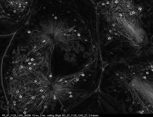 CIL:12026, Nephrotoma, Nephrotoma suturalis, primary spermatocyte