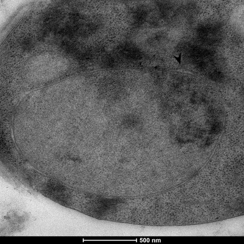 CIL: 50869, Saccharomyces cerevisiae (baker's yeast, budding yeast), Mixed population of S. cerevisiae cells