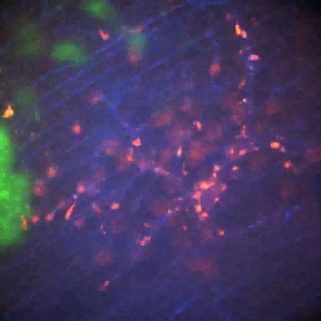 CIL:47391, Staphylococcus aureus, neutrophil, endothelial cell