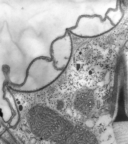 CIL:39310, Paramecium multimicronucleatum, cell by organism, eukaryotic cell, Eukaryotic Protist, Ciliated Protist