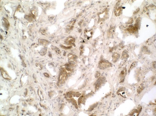 CIL:33212, Homo sapiens, endocrine-paracrine cell of prostate gland, basal cell of prostate epithelium, luminal cell of prostate epithelium, blood vessel endothelial cell, perineural cell, sheath cell, leukocyte, prostate stromal cell, smooth muscle cell of prostate