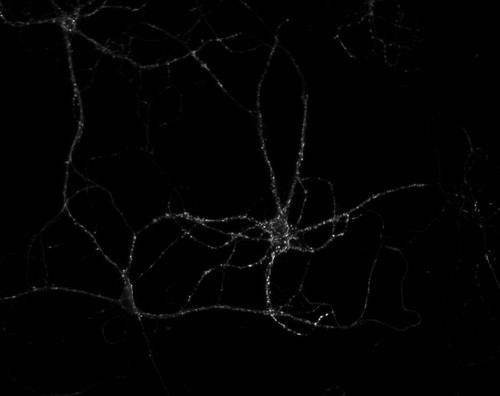 CIL:36161, Rattus, multipolar neuron