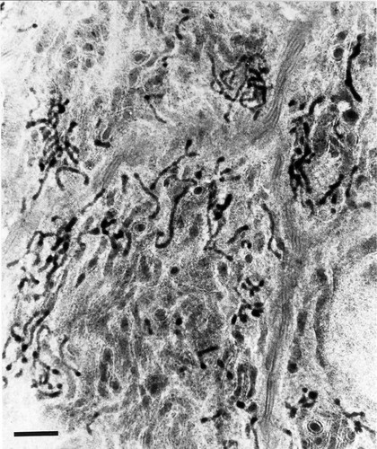 CIL:46753, Homo sapiens, epithelial cell