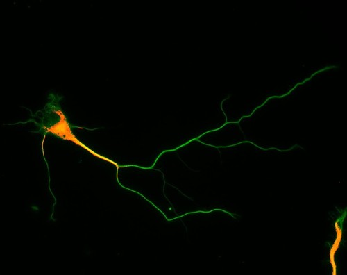 CIL:8275, Rattus, multipolar neuron