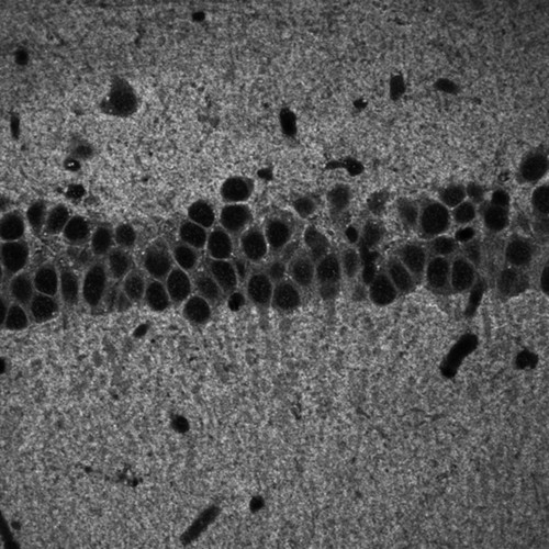 CIL:40127, Mus musculus, CNS neuron (sensu Vertebrata)