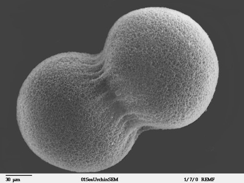 CIL:39782, Lytechinus pictus, embryonic cell