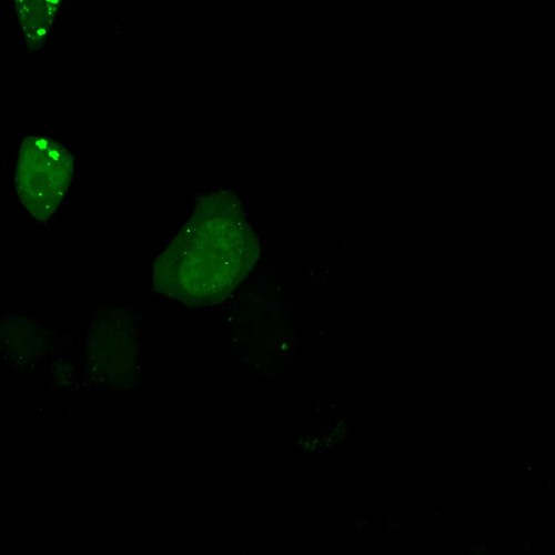 CIL:13906, Homo sapiens, permanent cell line cell