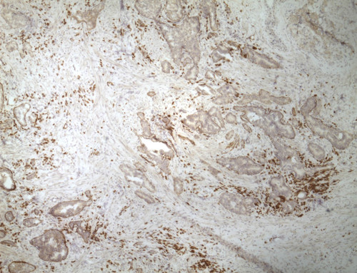 CIL:32673, Homo sapiens, endocrine-paracrine cell of prostate gland, basal cell of prostate epithelium, luminal cell of prostate epithelium, blood vessel endothelial cell, perineural cell, sheath cell, leukocyte, prostate stromal cell, smooth muscle cell of prostate