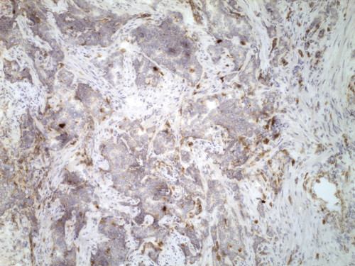 CIL:32567, Homo sapiens, endocrine-paracrine cell of prostate gland, basal cell of prostate epithelium, luminal cell of prostate epithelium, blood vessel endothelial cell, perineural cell, sheath cell, leukocyte, prostate stromal cell, smooth muscle cell of prostate