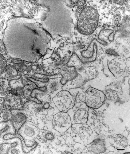 CIL:36745, Paramecium multimicronucleatum, cell by organism, eukaryotic cell, Eukaryotic Protist, Ciliated Protist