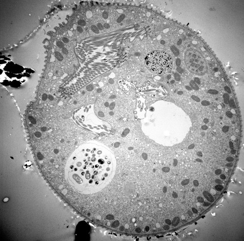 CIL:40573, Vorticella convallaria, cell by organism, eukaryotic cell, Eukaryotic Protist, Ciliated Protist