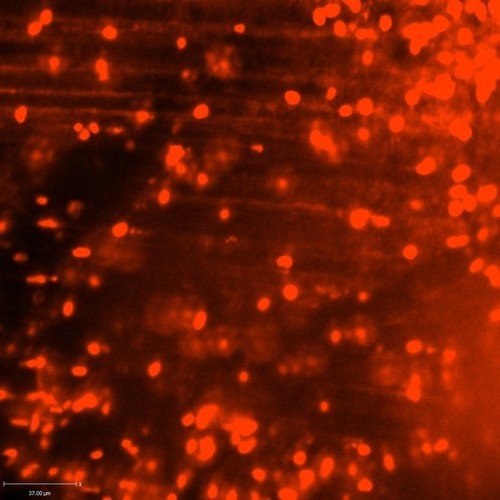 CIL:47311, Staphylococcus aureus, neutrophil, endothelial cell