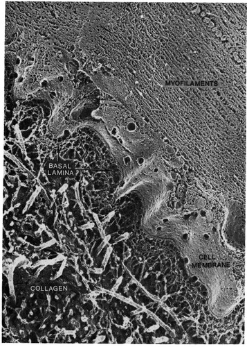 CIL:10954, skeletal muscle cell